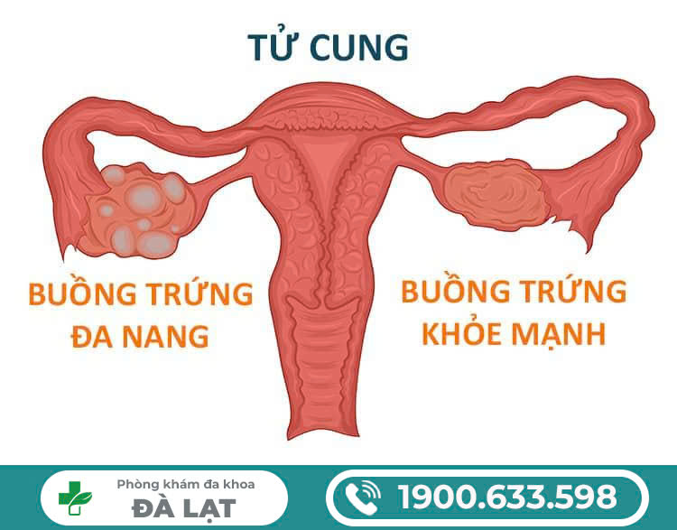 Hình ảnh minh họa